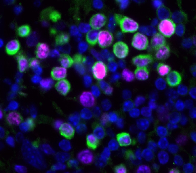 Flourescent image of mouse lung with influenza virus that shows blue and pink cells, some of them rimmed with green.